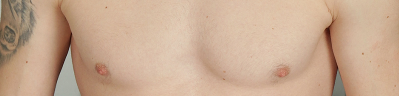 File:Small Chest hair.png